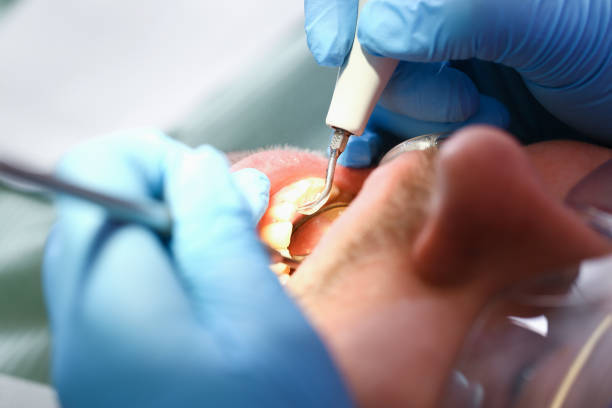 Best Emergency Broken Tooth Repair in Durand, IL