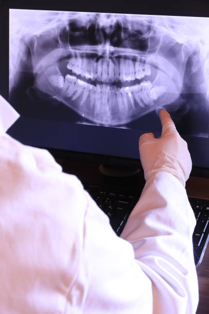 Best Emergency Dental Surgery in Durand, IL